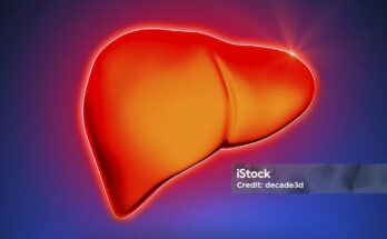 Hepatitis B: Causes, Symptoms, and Treatment