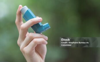 Understanding Asthma